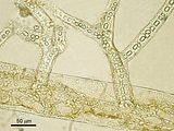 1 – Talli epifiti su Ceramium ciliatum var. robustum